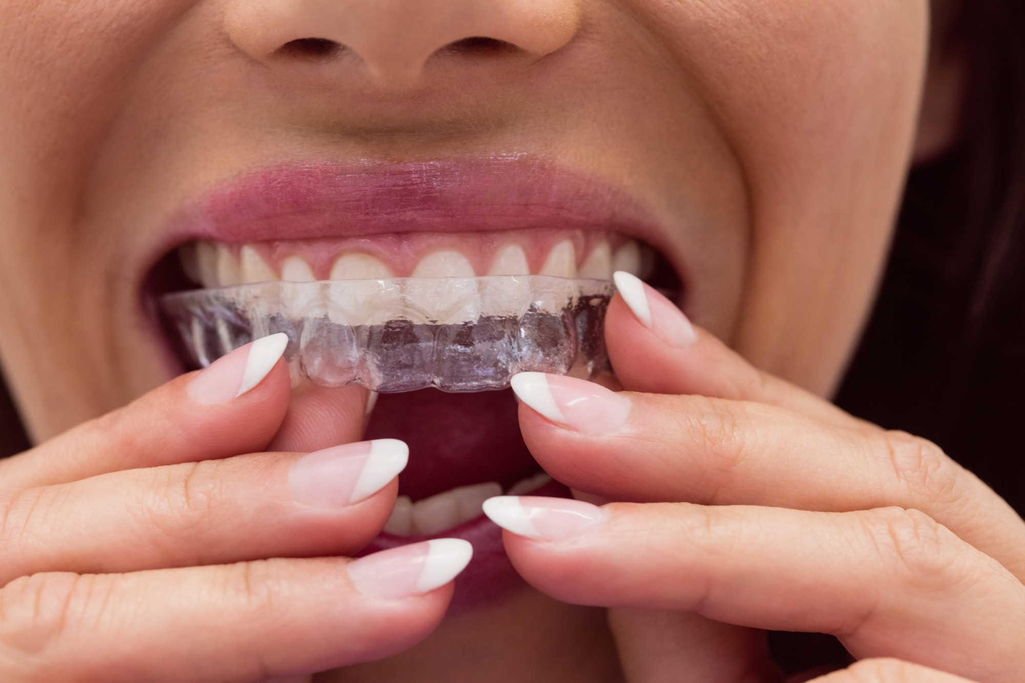 Dentures