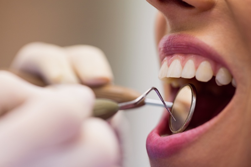 Tooth Filling